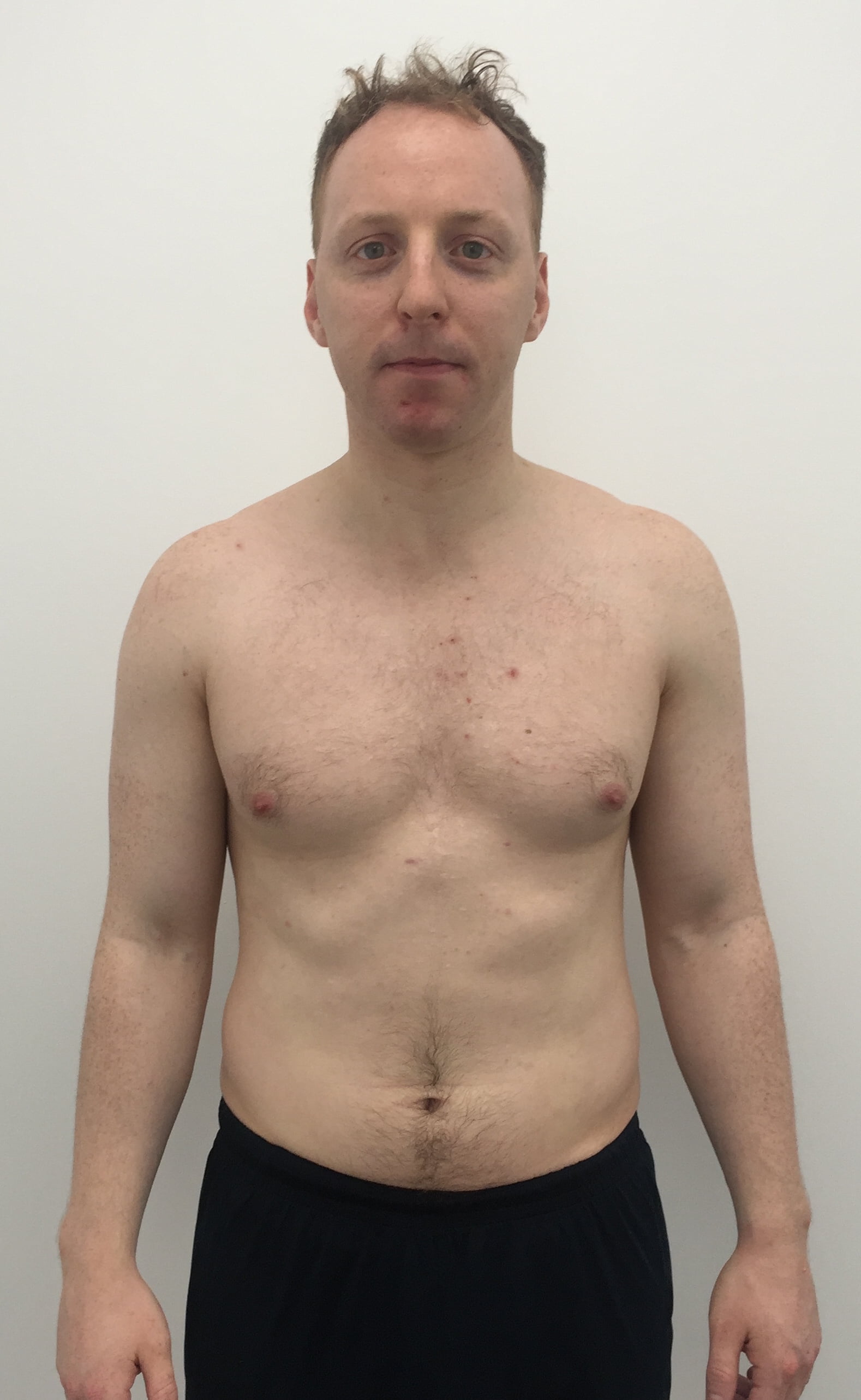 Male body transformation before photo at Roar Fitness London