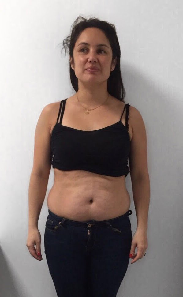 Female before photo body transformation beginning at Roar Fitness London