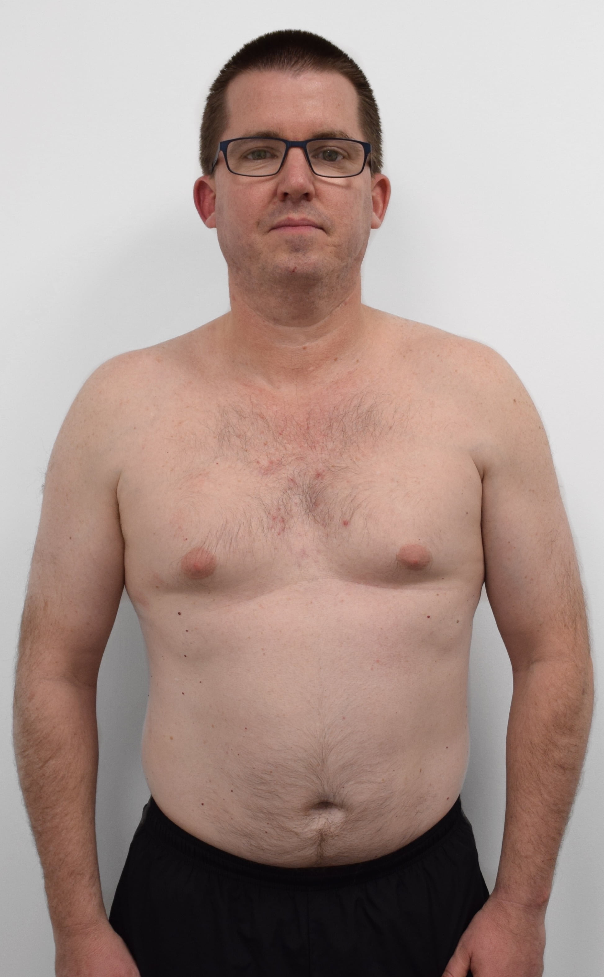 Male body transformation before photo at Roar Fitness London