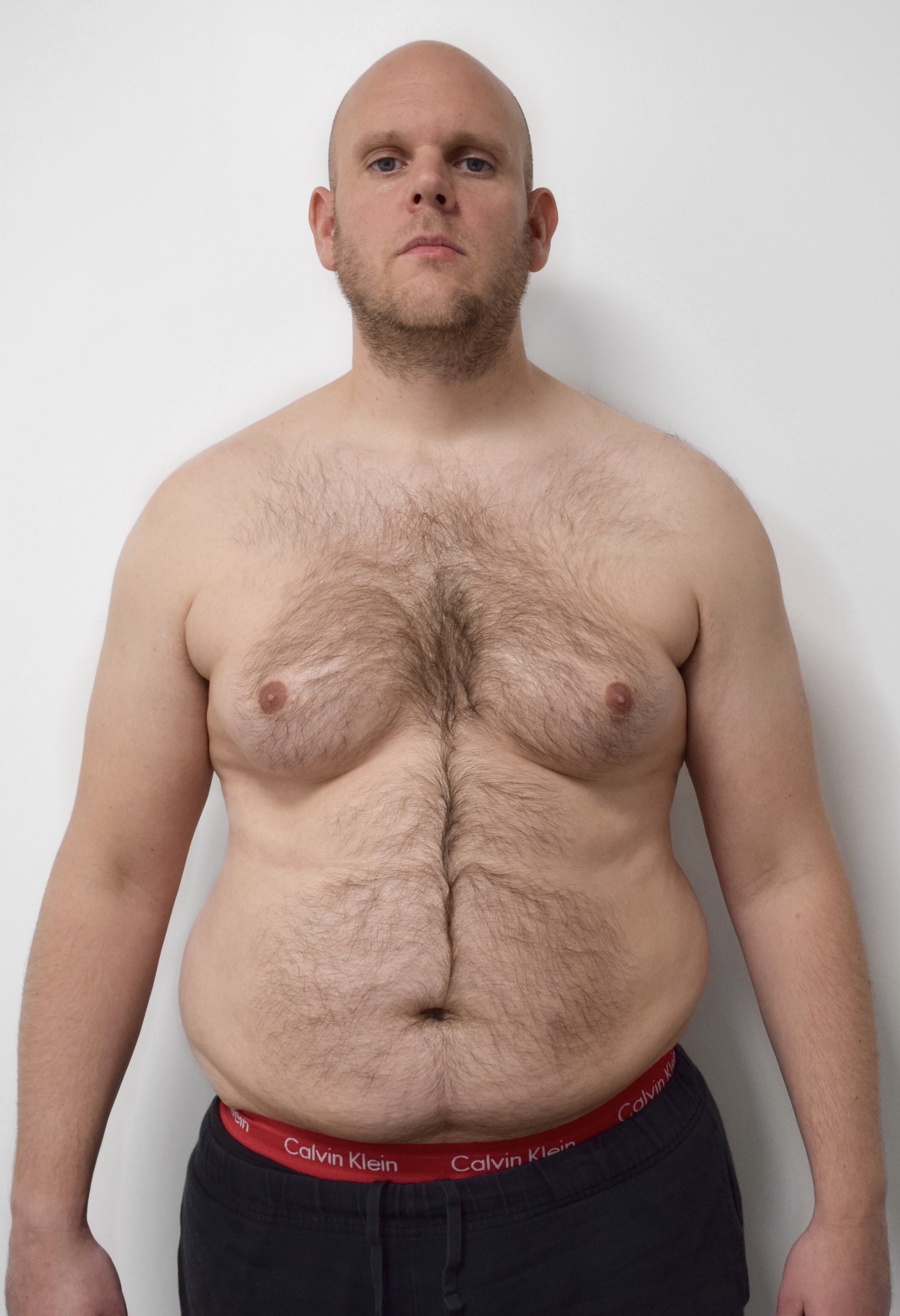 Male body transformation before photo at Roar Fitness