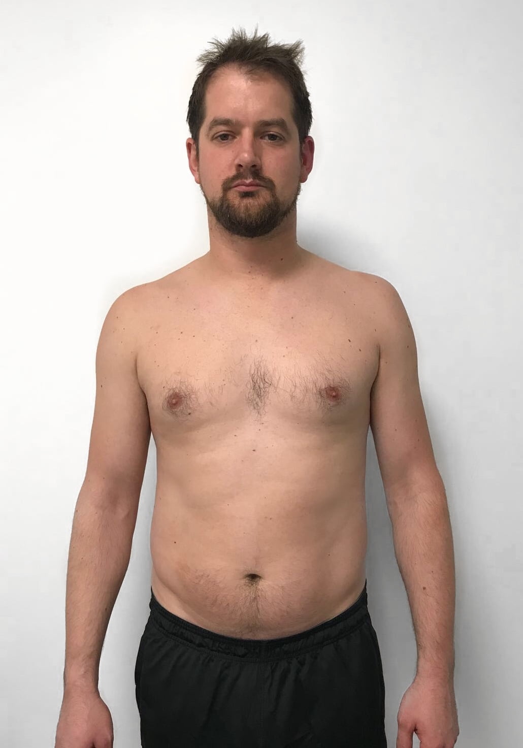 Female body transformation after photo from elite personal training Roar Fitness