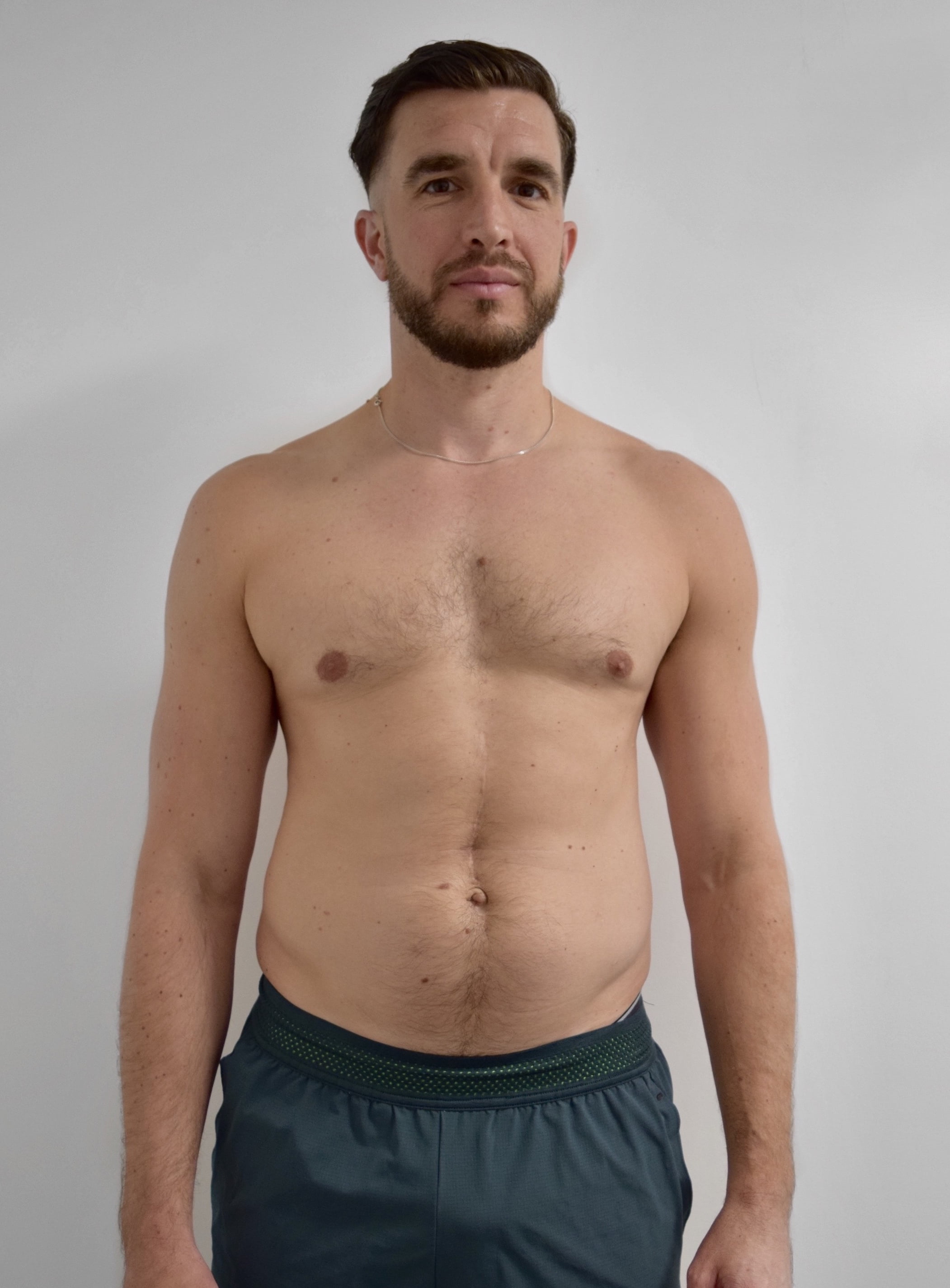 Male body transformation before photo at Roar Fitness