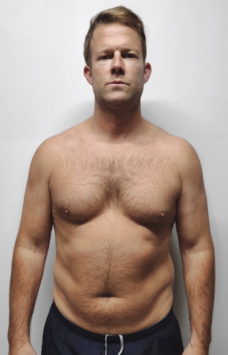A man before his fitness transformation, standing against a white background, showcasing his initial physique.