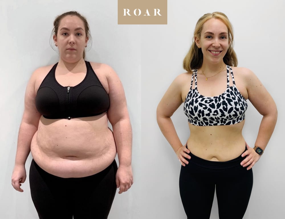 Evie before and after her female body transformation at ROAR Fitness London, 30kg weight loss